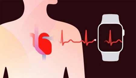 AppleWatch心电图国内可以用吗(图文)